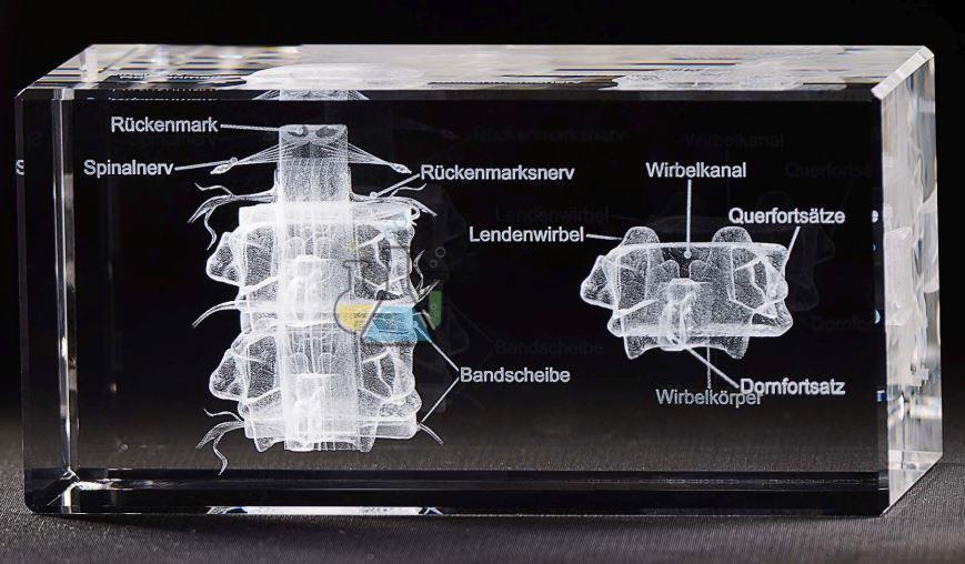 Vertebrae with Nerves 3D Model in Glass